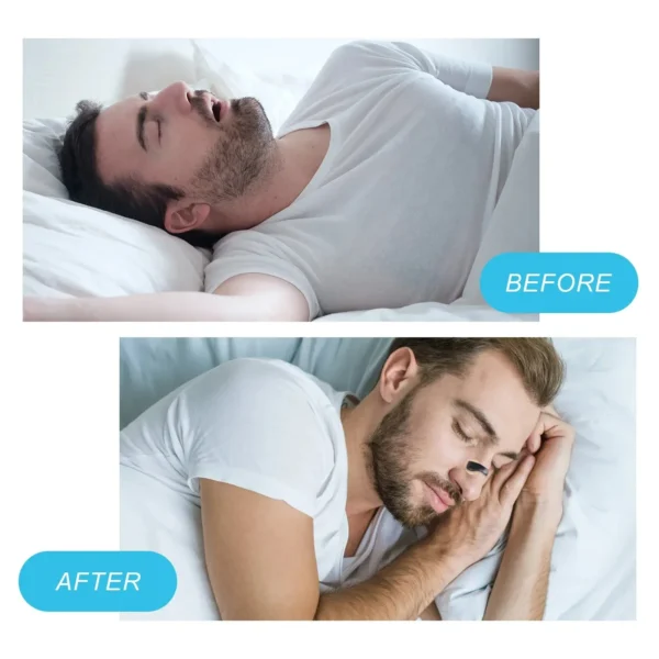 Anti-snoring Nose Clip Nasal Breathing Dilators Starter Kits Magnetic Nose Strips Increase Sports Air Intake Improve Sleeping - Image 4